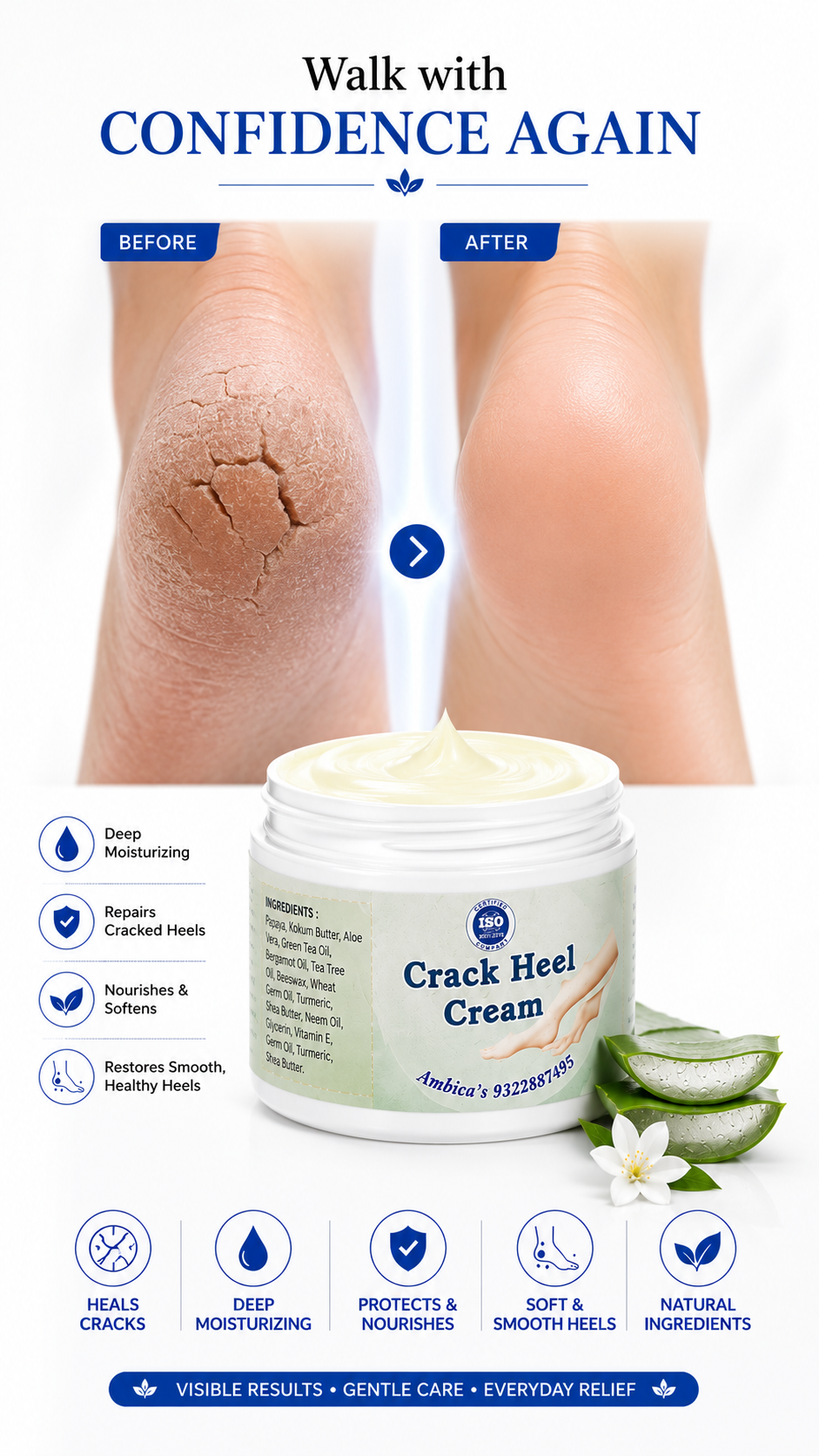 Crack Heel Cream